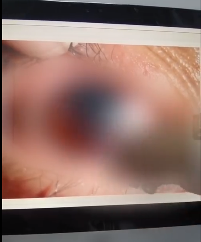 胆小勿入！保温杯泡红枣10多天拧开爆炸 这个女孩遭遇了什么？