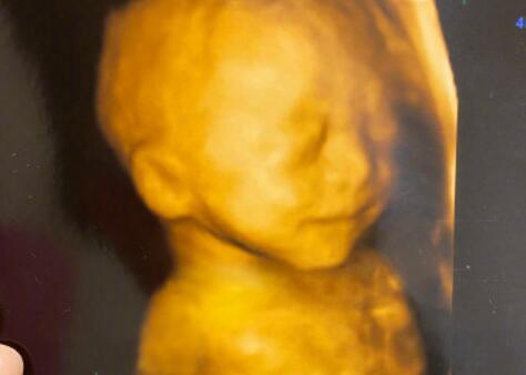 【吃瓜围观】宁桓宇当爸是怎么回事?宁桓宇是哪届快男？宁桓宇妻子是谁？