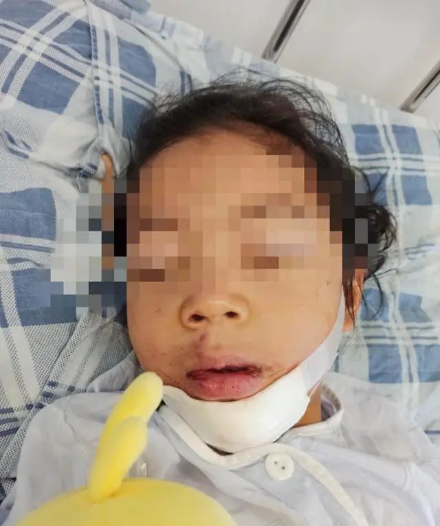 揪心！4岁女童被锁幼儿园二楼反思坠楼摔伤，教育局回应