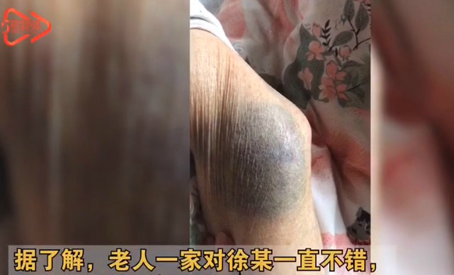 丧心病狂!保姆虐待患病老人获刑1年禁业3年,现在知道错了?