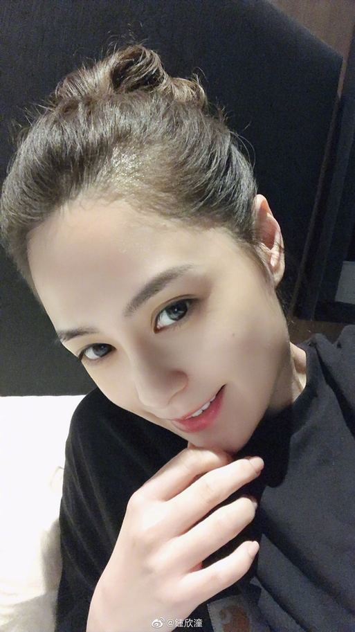 阿娇或需再做手术具体是什么情况?到底发生了什么?怎么伤的这么重?