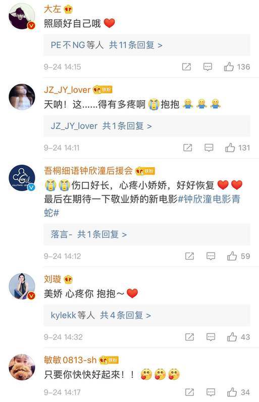 会毁容吗?阿娇首晒高清伤口照片 眉心到眉骨布满针眼