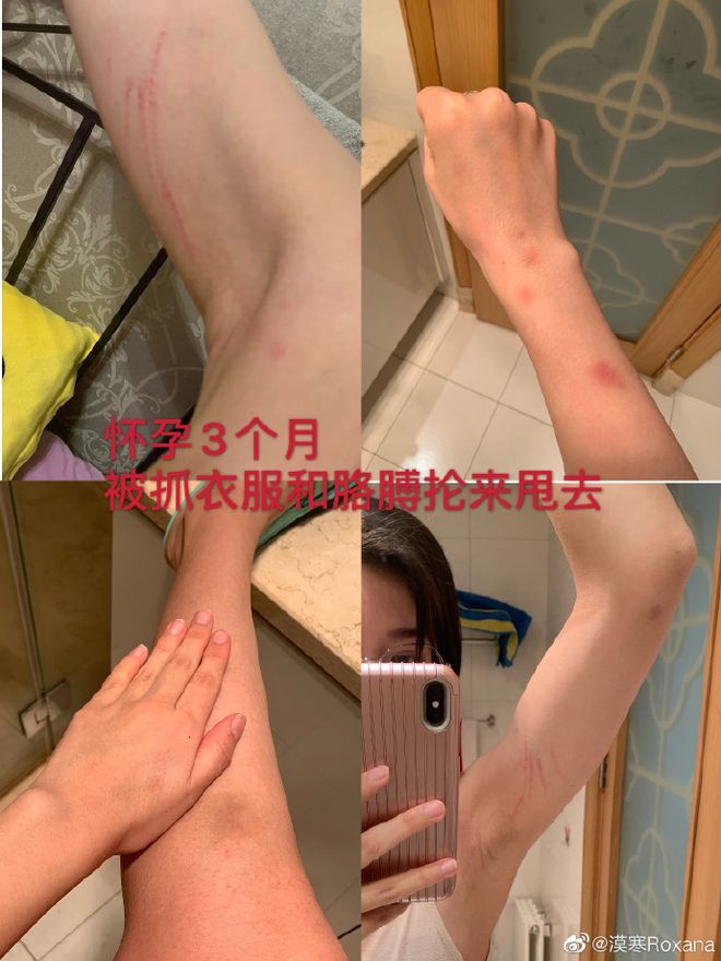【围观】短跑名将张培萌被控诉家暴 到底发生了什么？