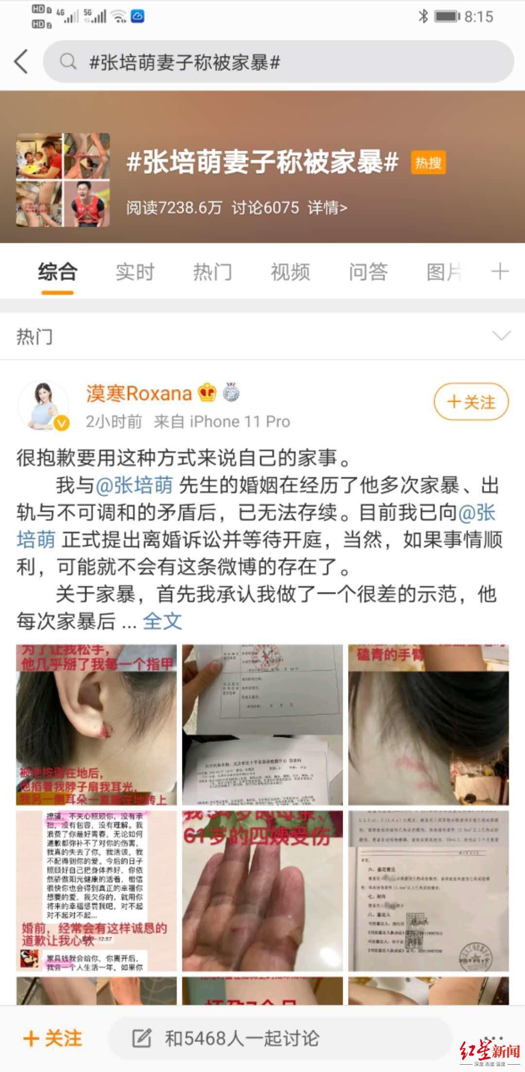 【反转】张培萌妻子称只想要女儿抚养权 到底咋回事?