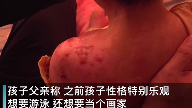 抚顺市回应6岁女童受虐案 抚顺被虐女童首诊医生发声