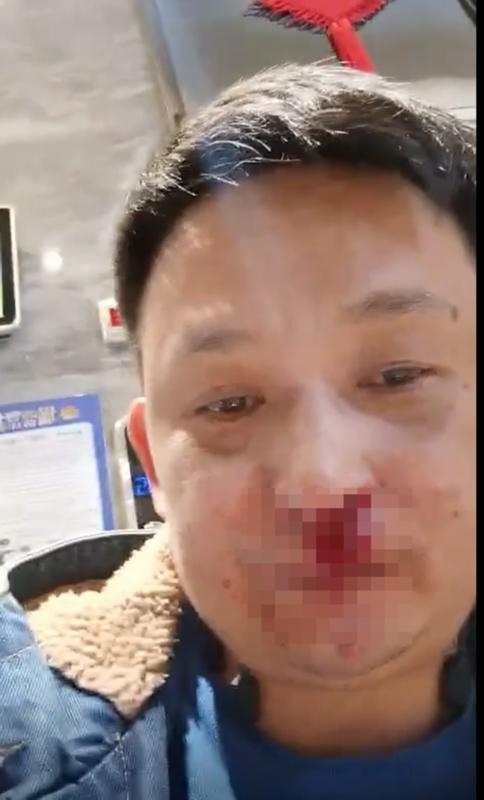 男子电梯里让路反被打骨折,到底发生了什么?
