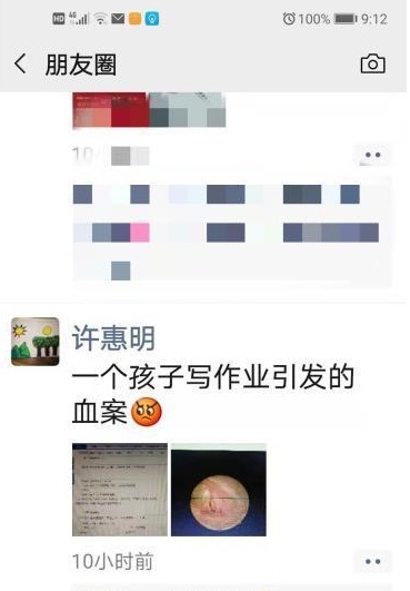 儿子写作业拖拉，爸爸一急，动手了 结果悲剧了