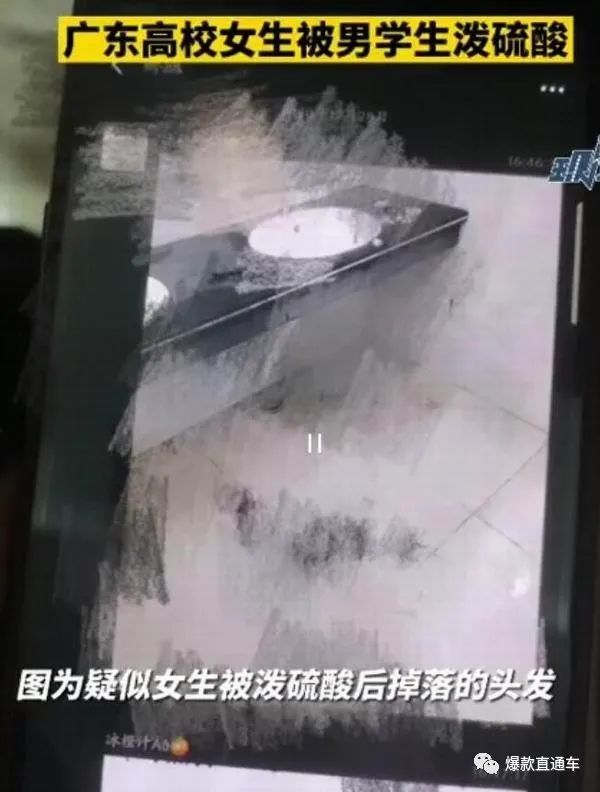 【后续】被泼化学物质女生或会毁容留疤，现场到底发生了什么？