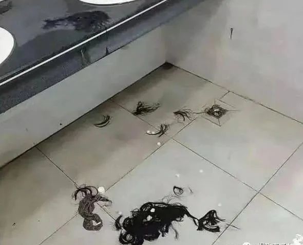 【后续】被泼化学物质女生或会毁容留疤，现场到底发生了什么？