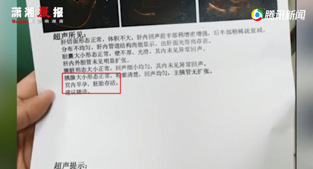 广东一男子医院就诊被查出怀孕，自嘲要寻找孩子父亲