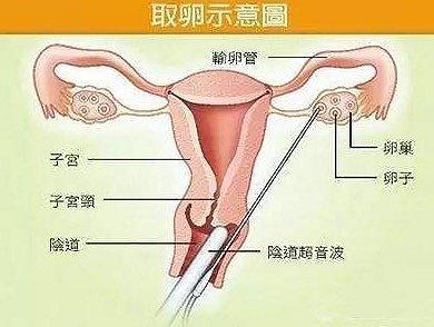 非法代孕产业链真相令人震惊!央视评代孕弃养:法律道德皆难容