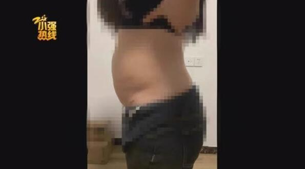 140斤的姑娘抽脂减肥，一次性抽掉4000毫升脂肪，结果却……