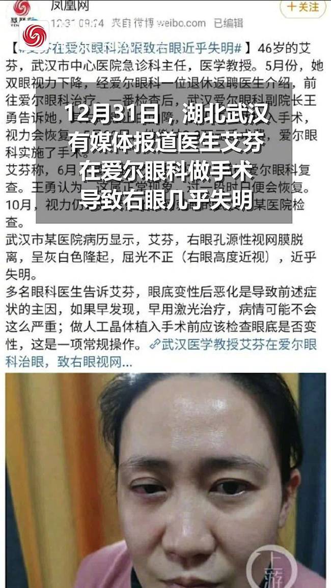 持续发酵！抗疫医生艾芬：已实名举报爱尔眼科 右眼近乎失明