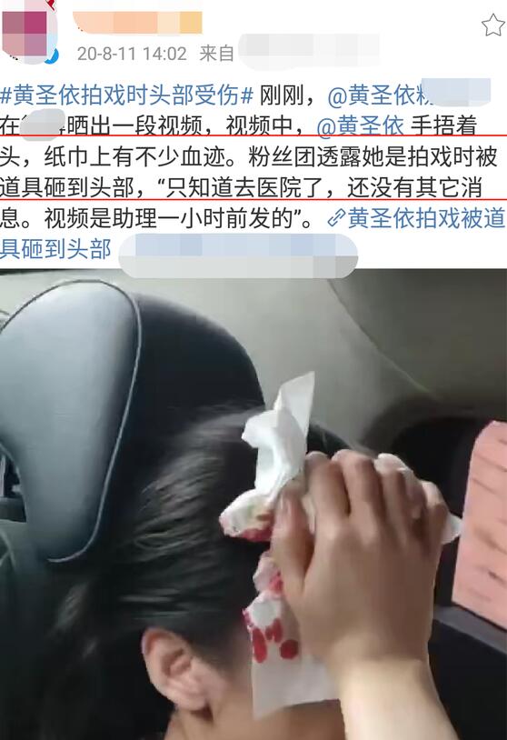 蔡少芬录节目时被狗咬伤 严重吗？目前情况如何？