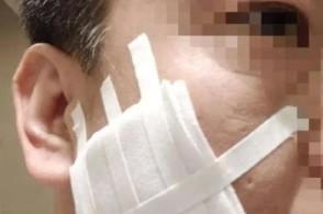 侮辱性惩罚!西安警方通报职员遭高管烟头烫脸:已被刑拘