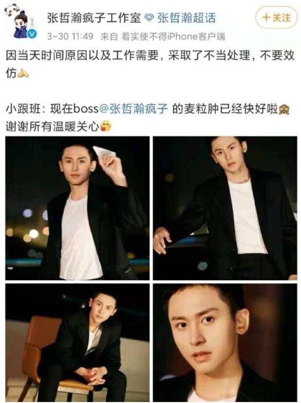 奇怪知识又增加了！专家说张哲瀚用眼影遮麦粒肿使不得