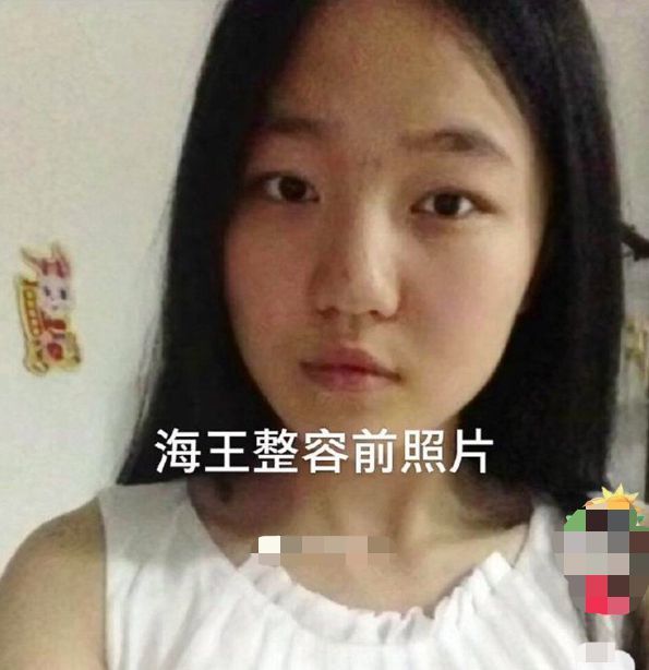 曝光女网红项思醒隐私 前男友被拘 女主整容前照片被扒判若两人
