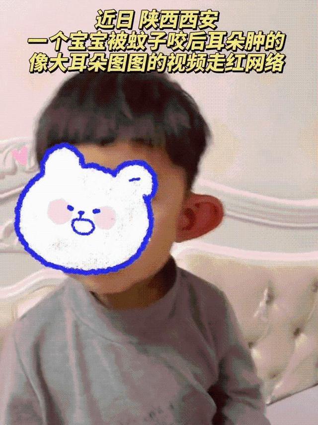 肿的发光发红!萌娃耳朵被蚊子叮成大耳朵图图,好笑又心疼