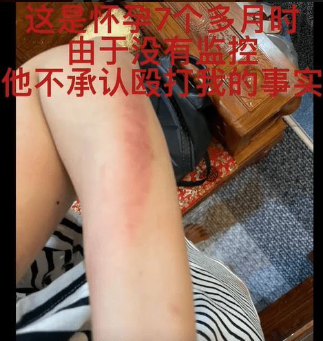 严重家暴妻子视频曝光 演员王东回应：终于解脱了