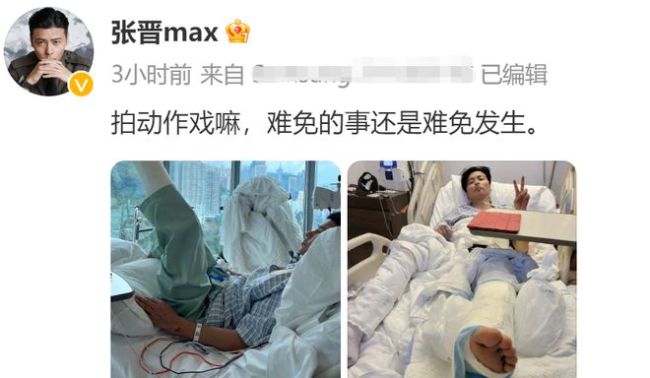 张晋拍戏受重伤住院 伤痕明显太憔悴插管吸氧