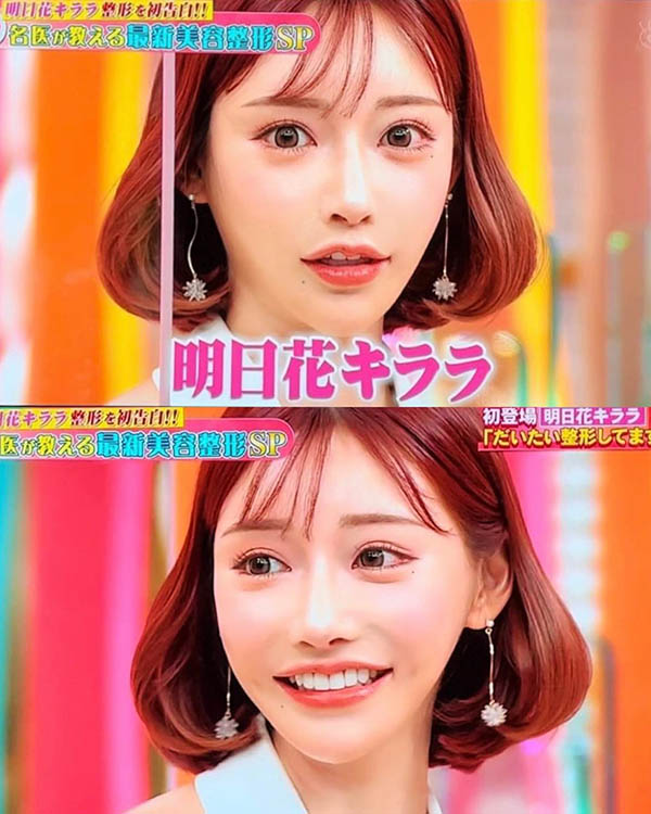 “明日花绮罗”首度承认全脸整形！但超完美“G罩杯豪乳”是纯天然性感曲线！