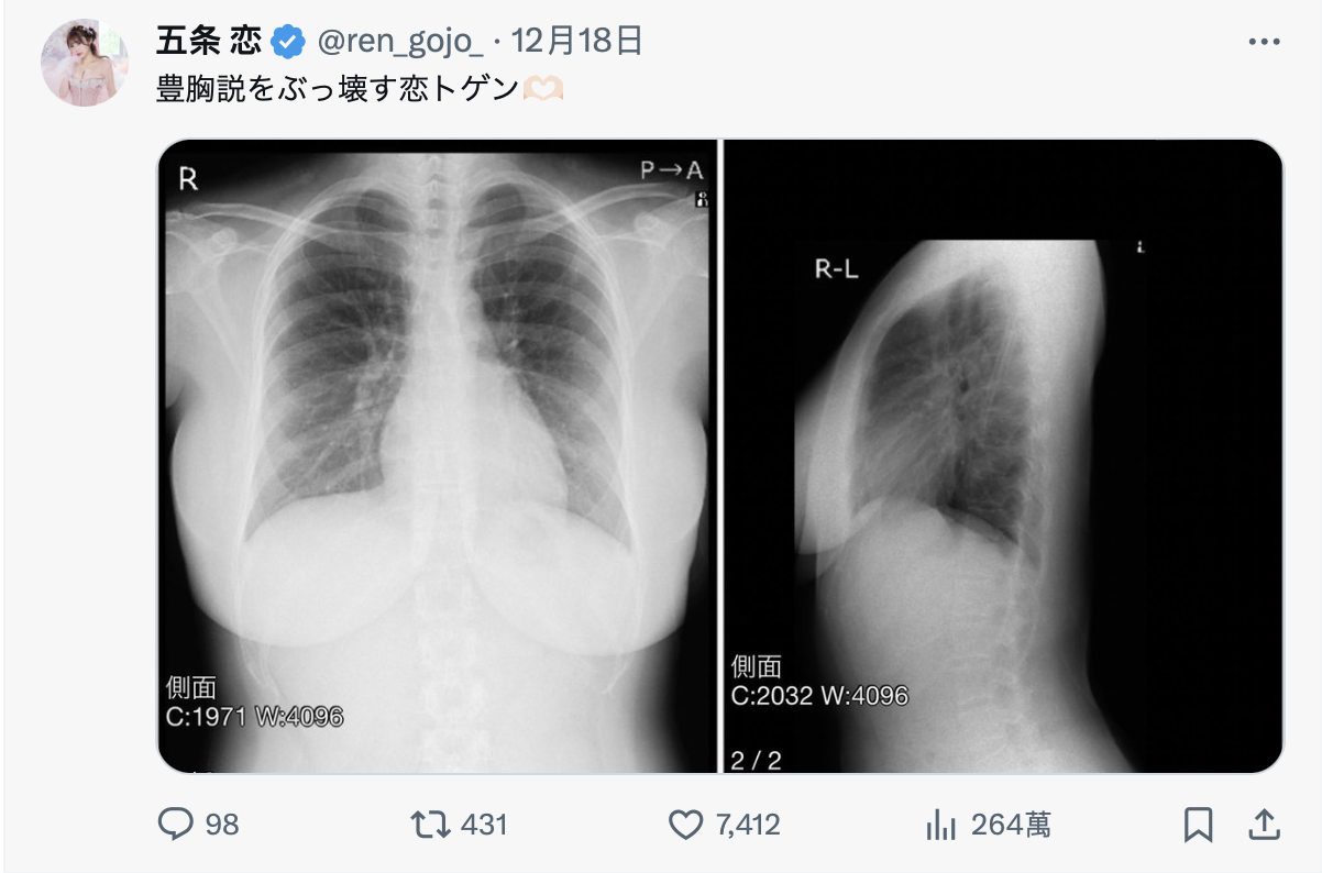 TSE最胸战士！(五条恋)不是一片限定！