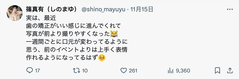 矫正牙齿中！史上最强隐藏巨R、最细JCup的她要变性感女神？ ...