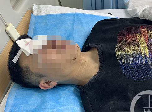 验房师验房遭殴打 殴打他人属于什么违法行为?