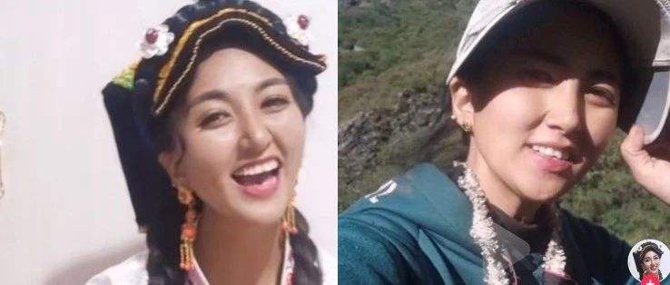 网红拉姆直播时被前夫烧伤生命垂危 已转至成都治疗