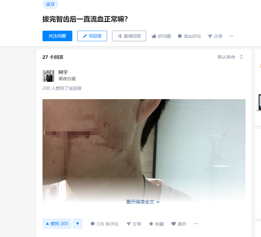26岁男子拔智齿流血多日后离世 家属提出赔偿60万
