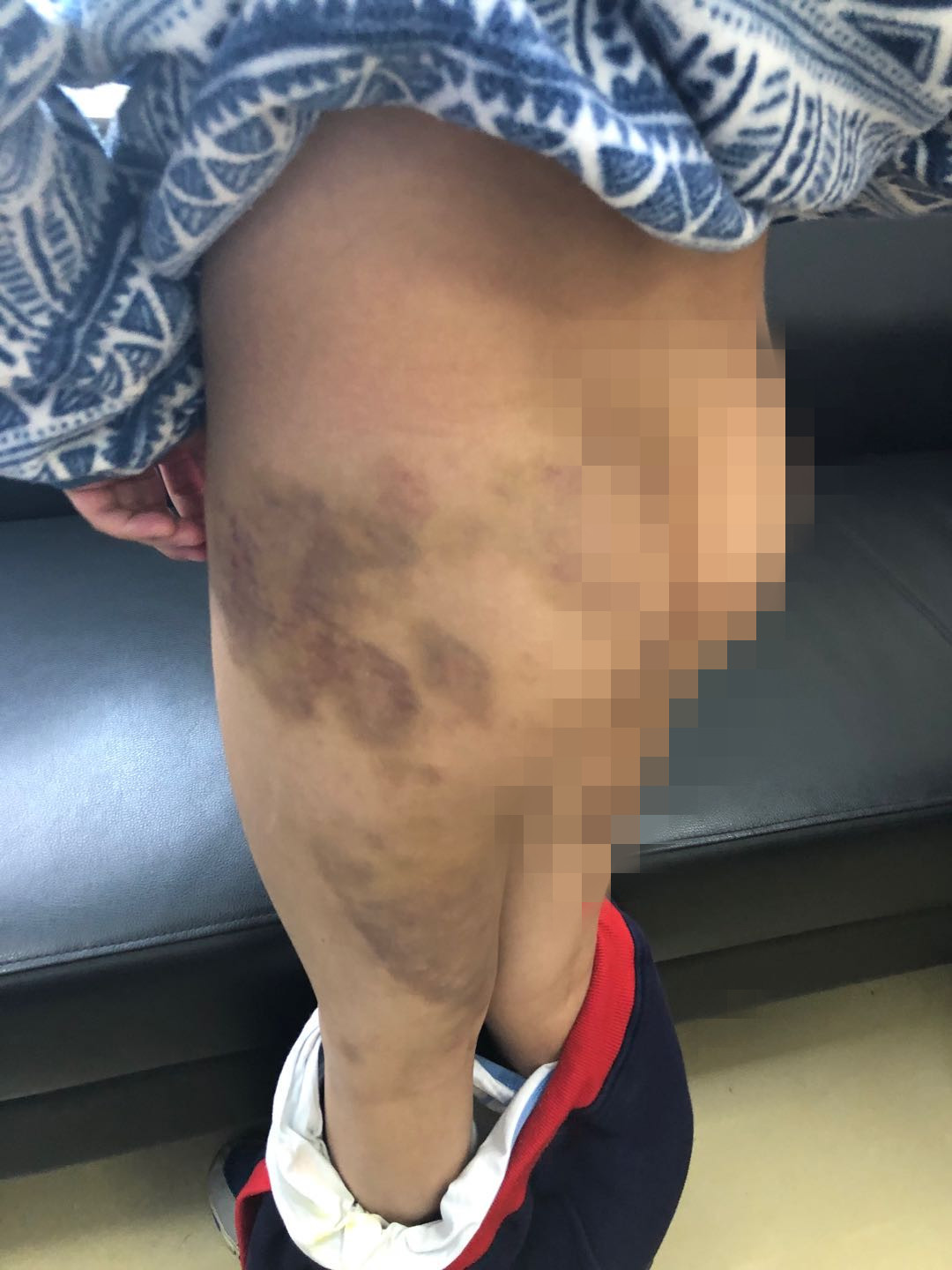 朱某大儿子的伤势 松江区检察院供图