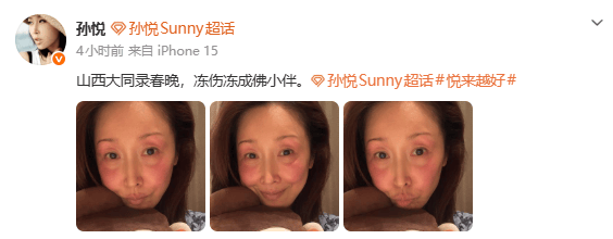 孙悦录节目被冻伤:山西大同录春晚 冻成佛小伴